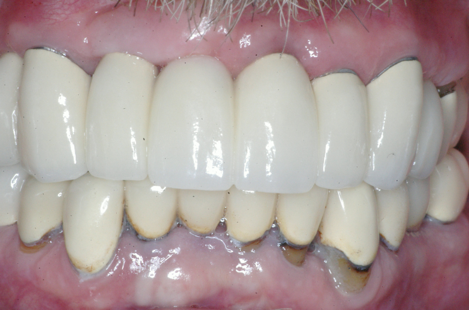 Eastlake Center for  Implants & Restorative Dentistry Eastlake Center for  Implants & Restorative Dentistry