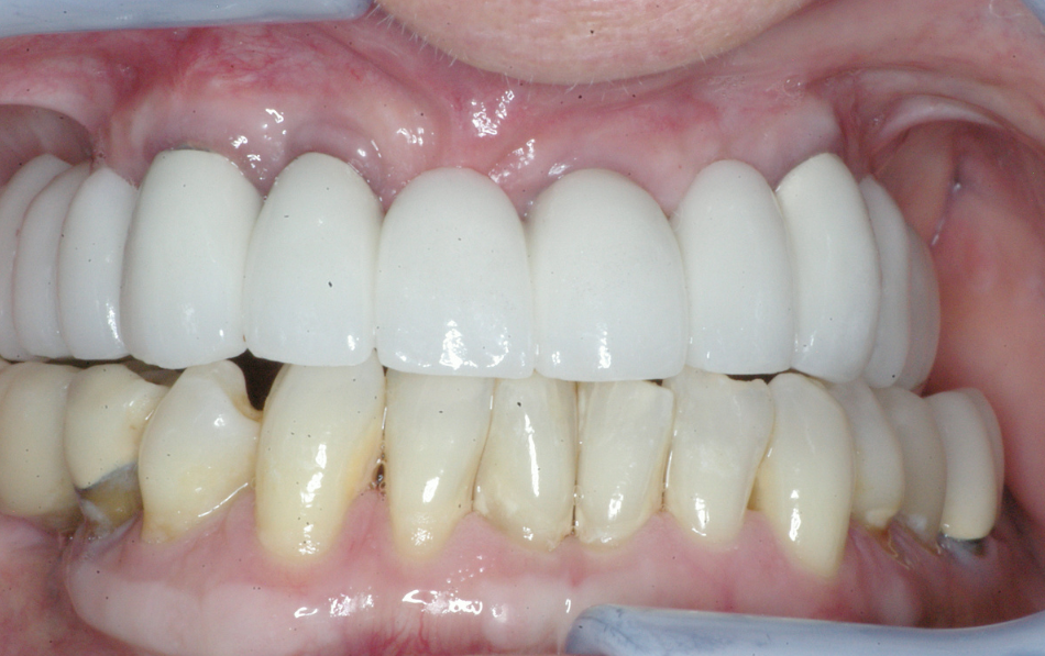 Eastlake Center for  Implants & Restorative Dentistry Eastlake Center for  Implants & Restorative Dentistry