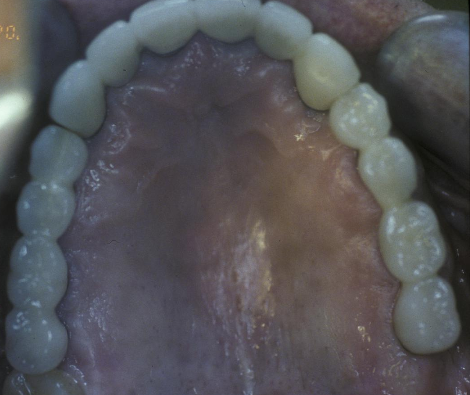 Eastlake Center for  Implants & Restorative Dentistry Eastlake Center for  Implants & Restorative Dentistry