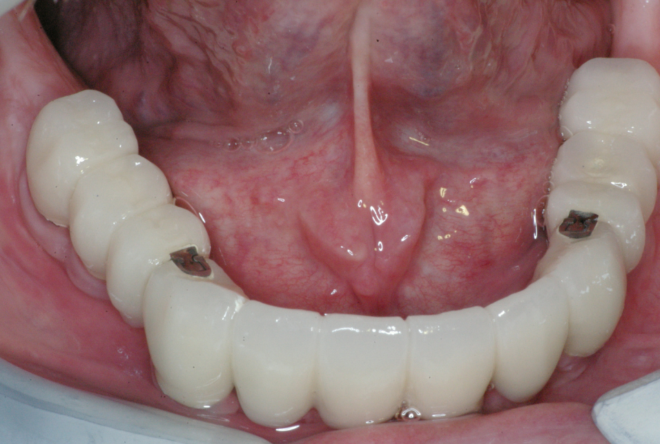 Eastlake Center for  Implants & Restorative Dentistry Eastlake Center for  Implants & Restorative Dentistry