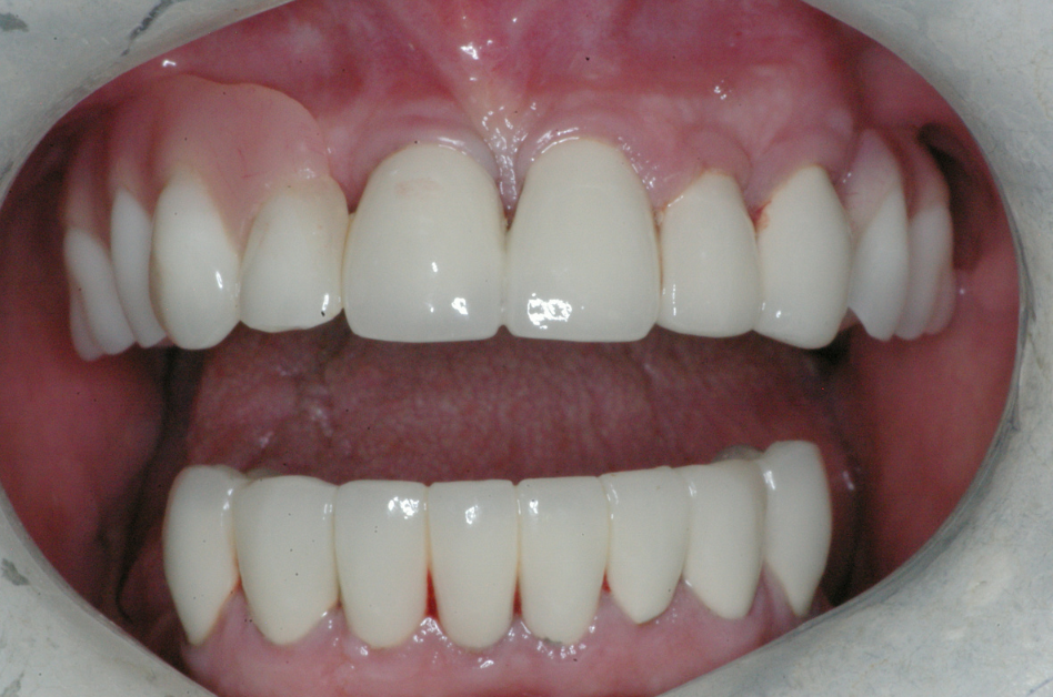 Eastlake Center for  Implants & Restorative Dentistry Eastlake Center for  Implants & Restorative Dentistry