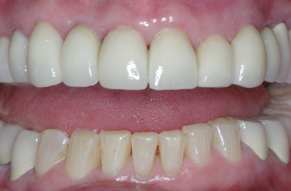 Eastlake Center for  Implants & Restorative Dentistry Eastlake Center for  Implants & Restorative Dentistry