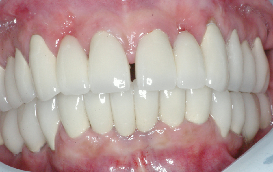Eastlake Center for  Implants & Restorative Dentistry Eastlake Center for  Implants & Restorative Dentistry