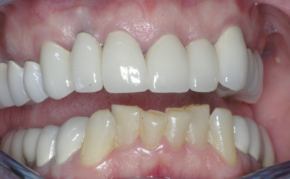 Eastlake Center for  Implants & Restorative Dentistry Eastlake Center for  Implants & Restorative Dentistry