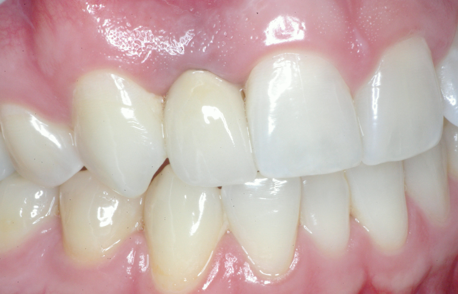 Eastlake Center for  Implants & Restorative Dentistry Eastlake Center for  Implants & Restorative Dentistry