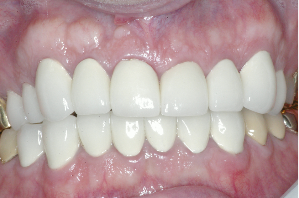 Eastlake Center for  Implants & Restorative Dentistry Eastlake Center for  Implants & Restorative Dentistry