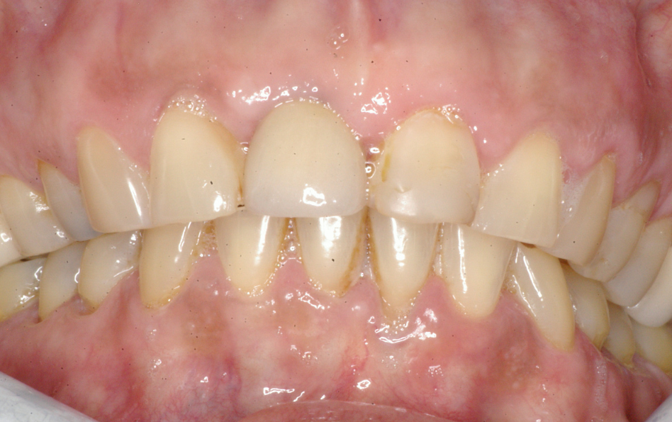 Eastlake Center for  Implants & Restorative Dentistry Eastlake Center for  Implants & Restorative Dentistry