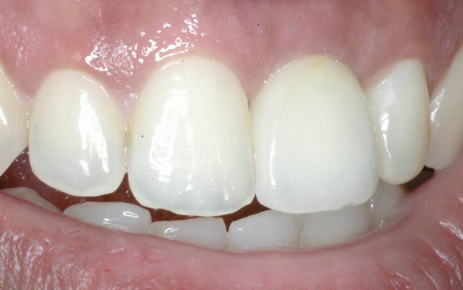 Eastlake Center for  Implants & Restorative Dentistry Eastlake Center for  Implants & Restorative Dentistry