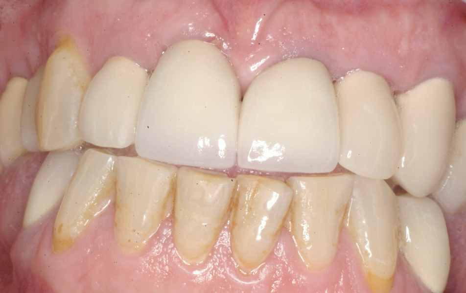 Eastlake Center for  Implants & Restorative Dentistry Eastlake Center for  Implants & Restorative Dentistry