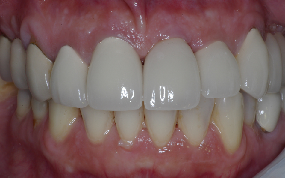 Eastlake Center for  Implants & Restorative Dentistry Eastlake Center for  Implants & Restorative Dentistry