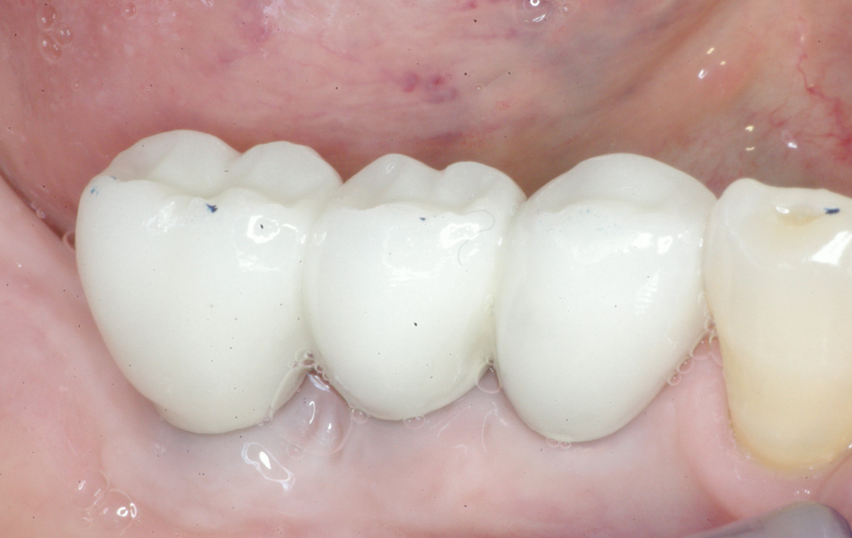 Eastlake Center for  Implants & Restorative Dentistry Eastlake Center for  Implants & Restorative Dentistry