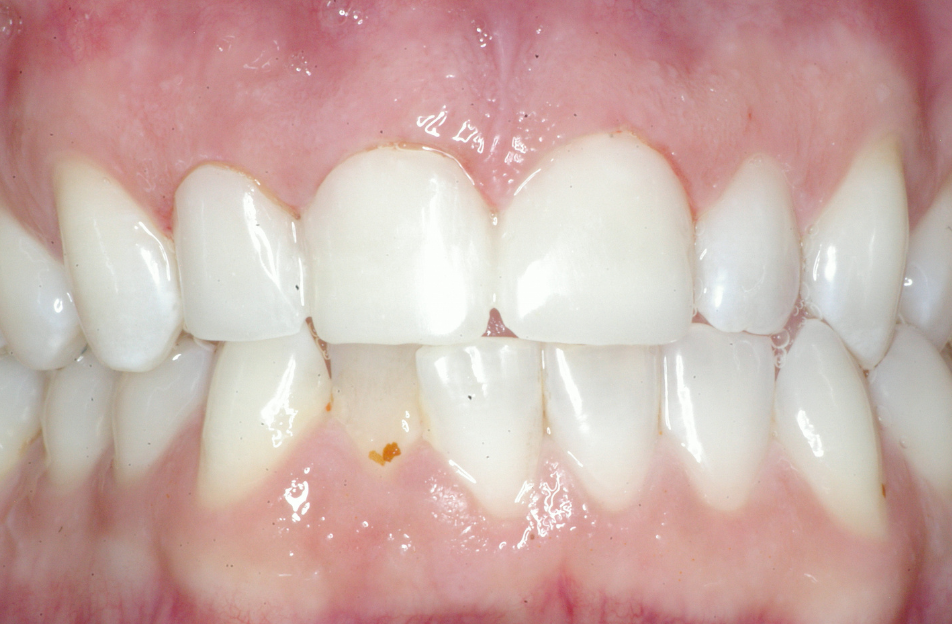 Eastlake Center for  Implants & Restorative Dentistry Eastlake Center for  Implants & Restorative Dentistry