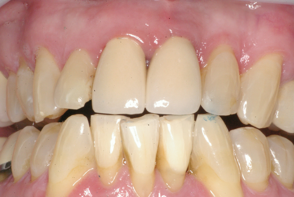 Eastlake Center for  Implants & Restorative Dentistry Eastlake Center for  Implants & Restorative Dentistry