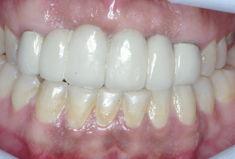 Eastlake Center for  Implants & Restorative Dentistry Eastlake Center for  Implants & Restorative Dentistry