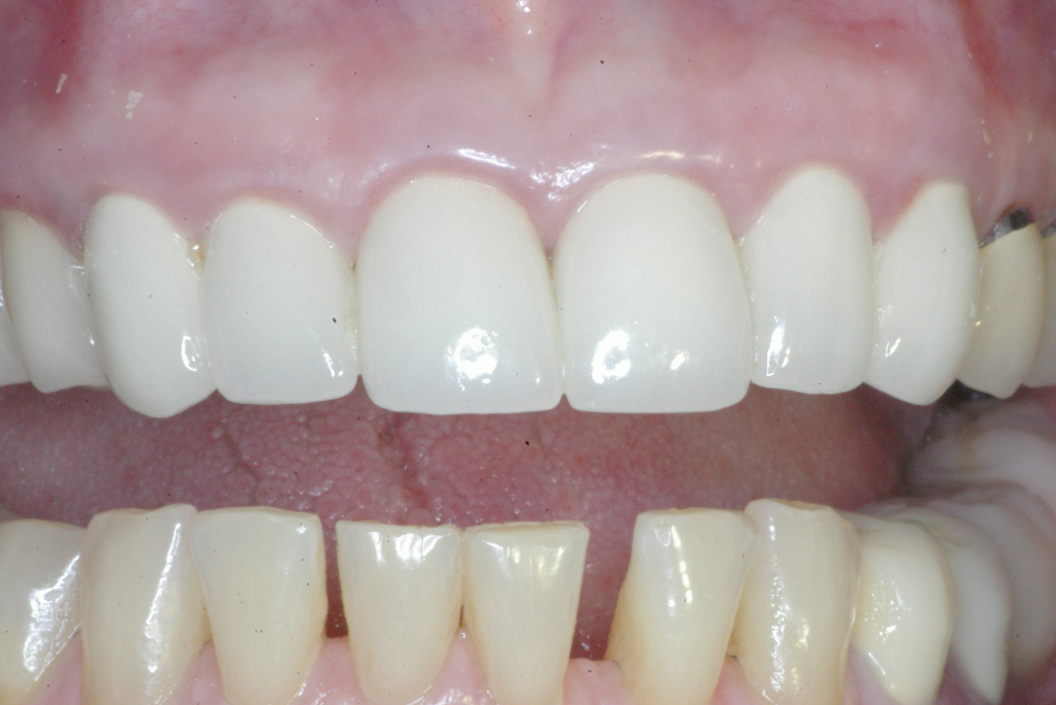 Eastlake Center for  Implants & Restorative Dentistry Eastlake Center for  Implants & Restorative Dentistry