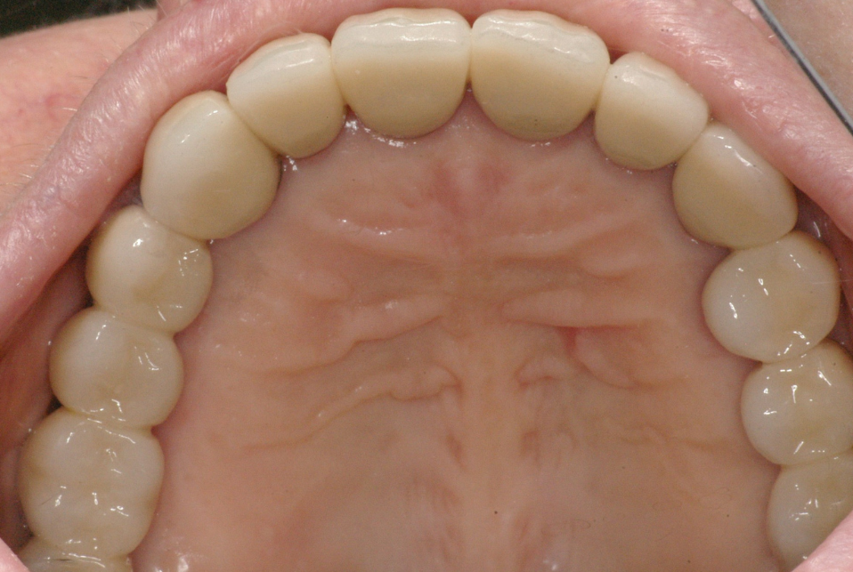 Eastlake Center for  Implants & Restorative Dentistry Eastlake Center for  Implants & Restorative Dentistry
