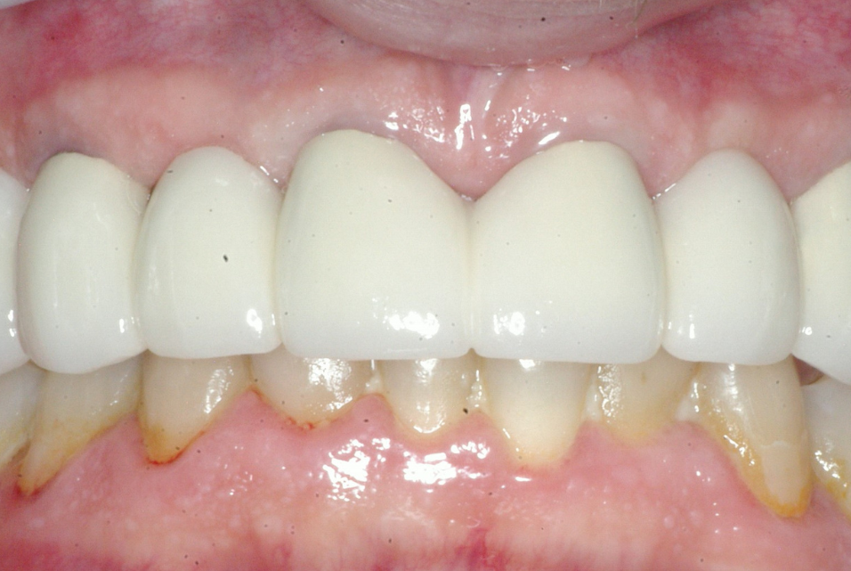 Eastlake Center for  Implants & Restorative Dentistry Eastlake Center for  Implants & Restorative Dentistry