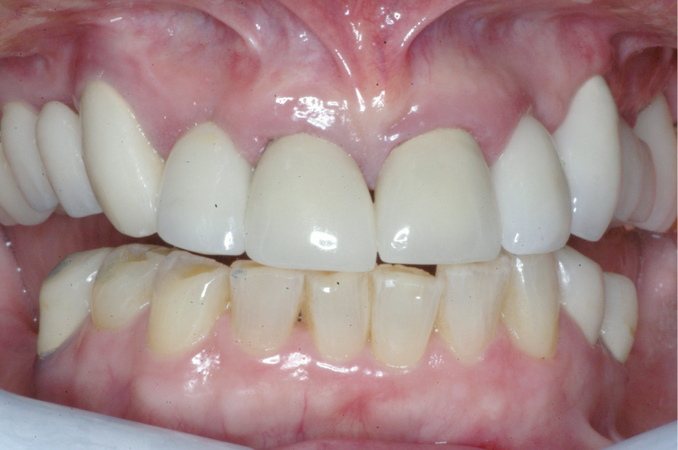 Eastlake Center for  Implants & Restorative Dentistry Eastlake Center for  Implants & Restorative Dentistry