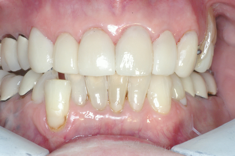 Eastlake Center for  Implants & Restorative Dentistry Eastlake Center for  Implants & Restorative Dentistry