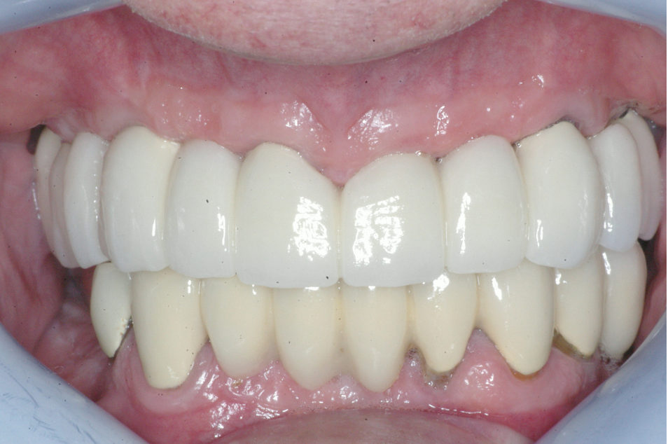 Eastlake Center for  Implants & Restorative Dentistry Eastlake Center for  Implants & Restorative Dentistry