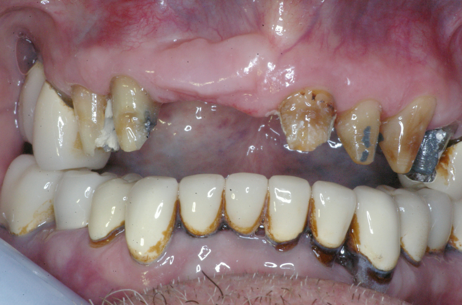 Eastlake Center for  Implants & Restorative Dentistry Eastlake Center for  Implants & Restorative Dentistry