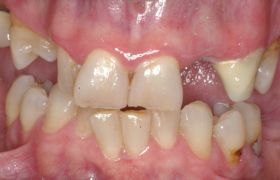Eastlake Center for  Implants & Restorative Dentistry Eastlake Center for  Implants & Restorative Dentistry