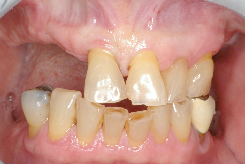 Eastlake Center for  Implants & Restorative Dentistry Eastlake Center for  Implants & Restorative Dentistry