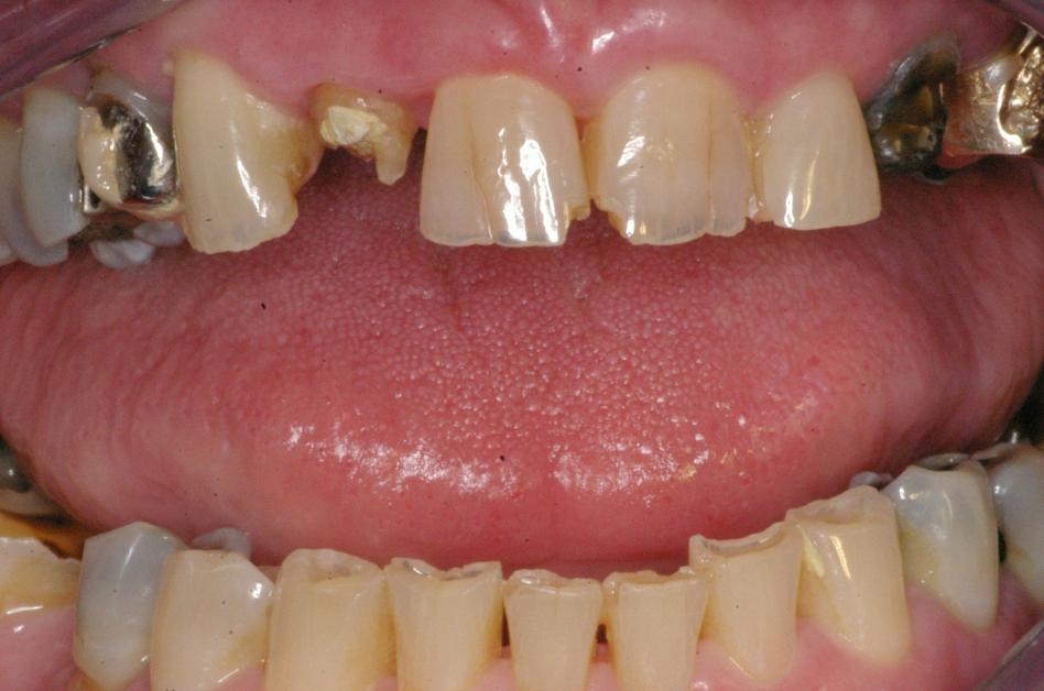 Eastlake Center for  Implants & Restorative Dentistry Eastlake Center for  Implants & Restorative Dentistry