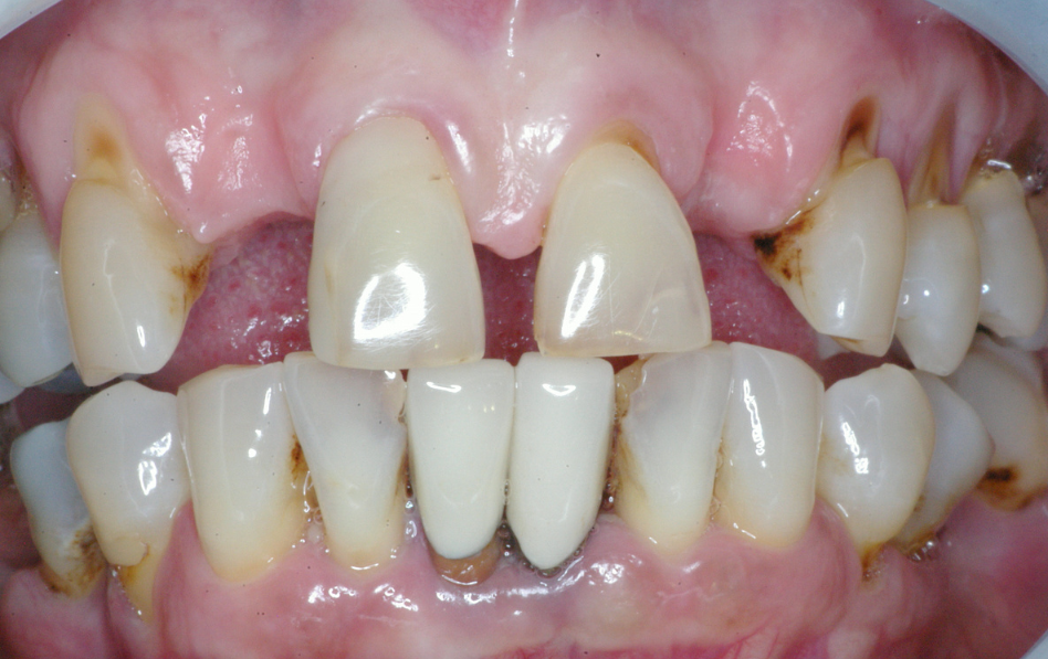 Eastlake Center for  Implants & Restorative Dentistry Eastlake Center for  Implants & Restorative Dentistry