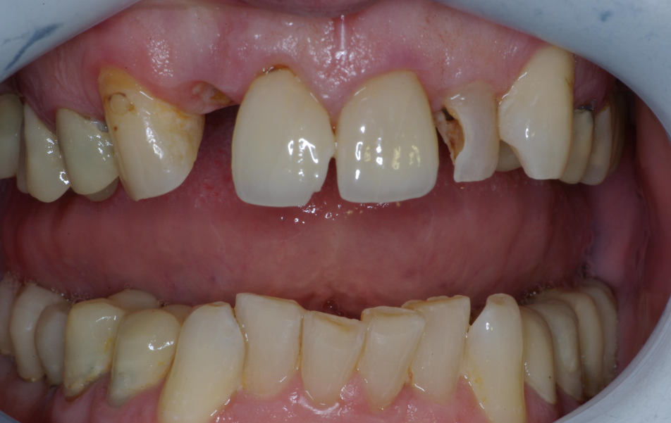 Eastlake Center for  Implants & Restorative Dentistry Eastlake Center for  Implants & Restorative Dentistry