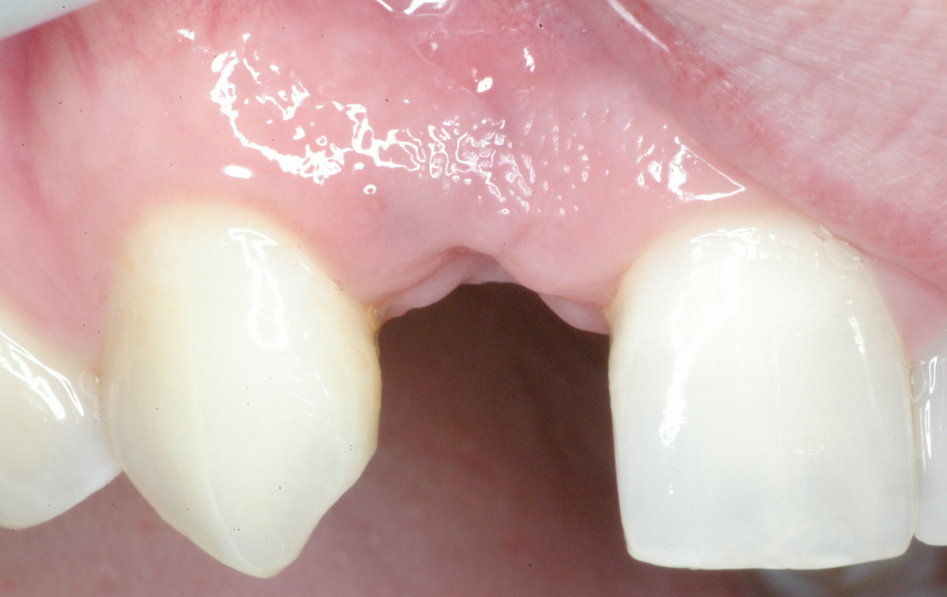 Eastlake Center for  Implants & Restorative Dentistry Eastlake Center for  Implants & Restorative Dentistry