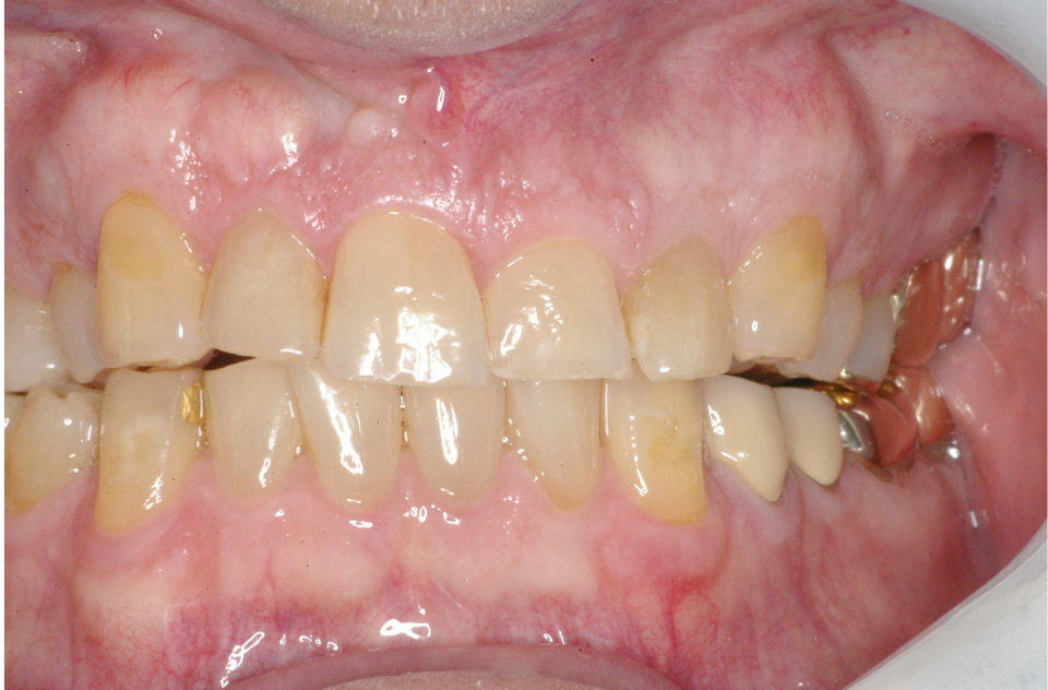 Eastlake Center for  Implants & Restorative Dentistry Eastlake Center for  Implants & Restorative Dentistry