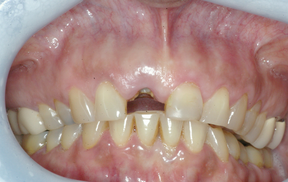 Eastlake Center for  Implants & Restorative Dentistry Eastlake Center for  Implants & Restorative Dentistry