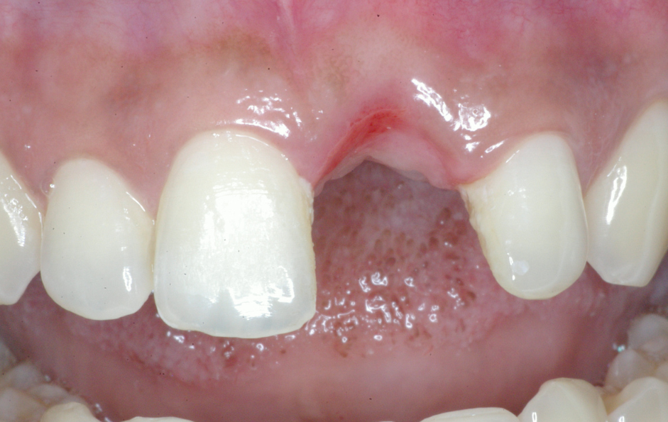 Eastlake Center for  Implants & Restorative Dentistry Eastlake Center for  Implants & Restorative Dentistry