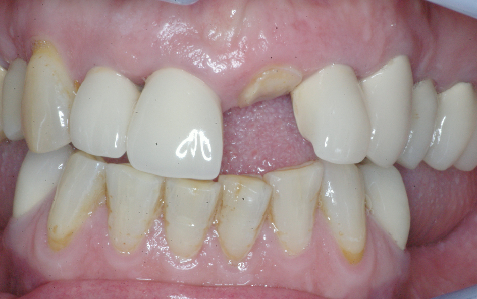 Eastlake Center for  Implants & Restorative Dentistry Eastlake Center for  Implants & Restorative Dentistry