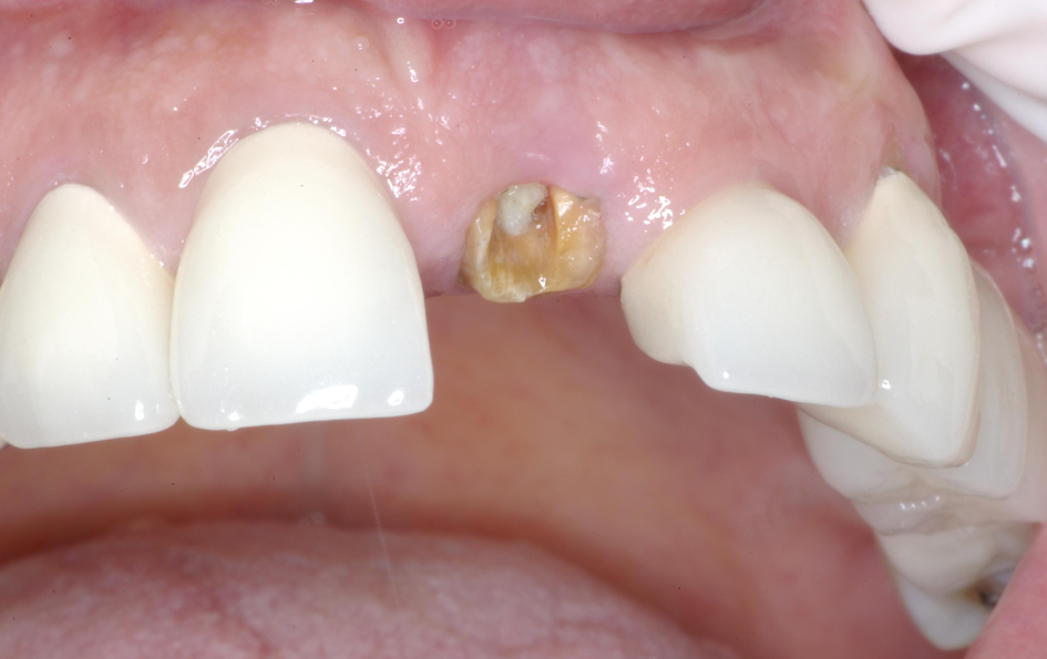 Eastlake Center for  Implants & Restorative Dentistry Eastlake Center for  Implants & Restorative Dentistry
