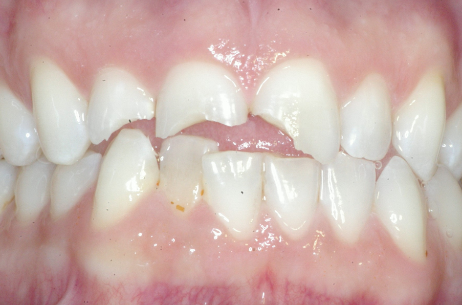 Eastlake Center for  Implants & Restorative Dentistry Eastlake Center for  Implants & Restorative Dentistry