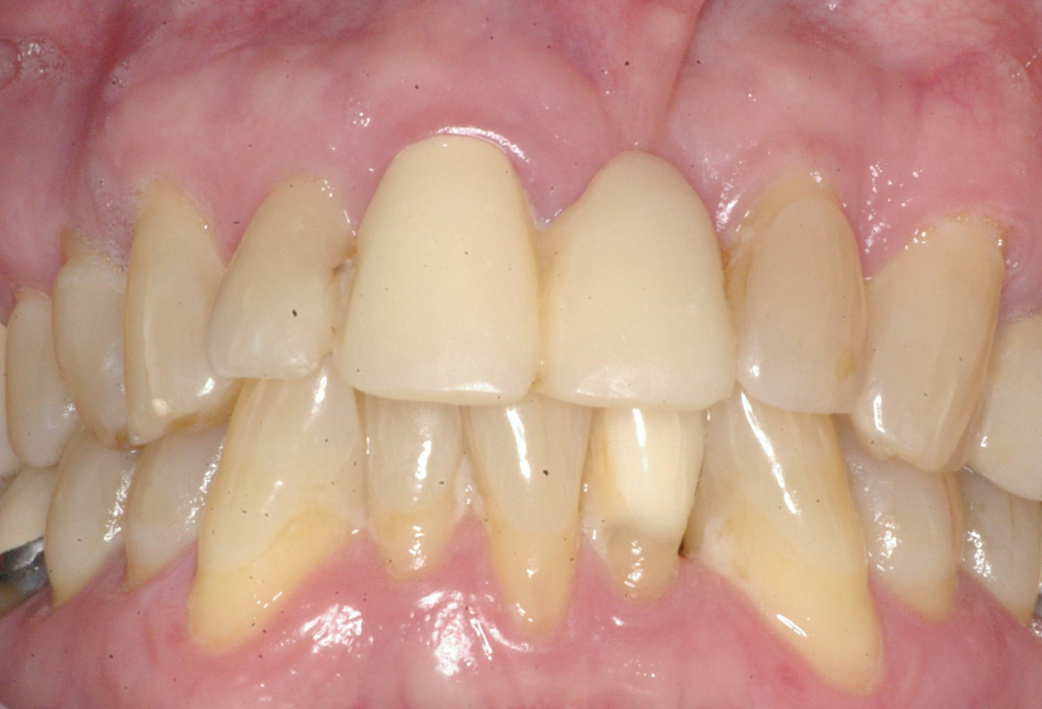 Eastlake Center for  Implants & Restorative Dentistry Eastlake Center for  Implants & Restorative Dentistry