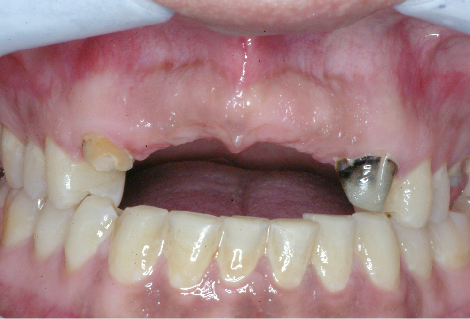 Eastlake Center for  Implants & Restorative Dentistry Eastlake Center for  Implants & Restorative Dentistry