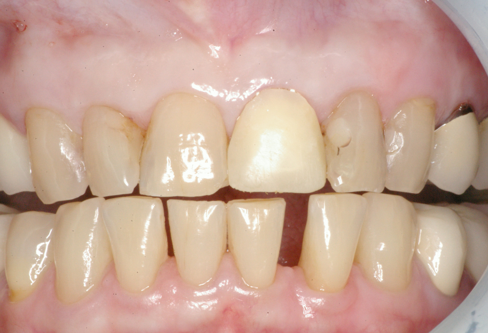 Eastlake Center for  Implants & Restorative Dentistry Eastlake Center for  Implants & Restorative Dentistry