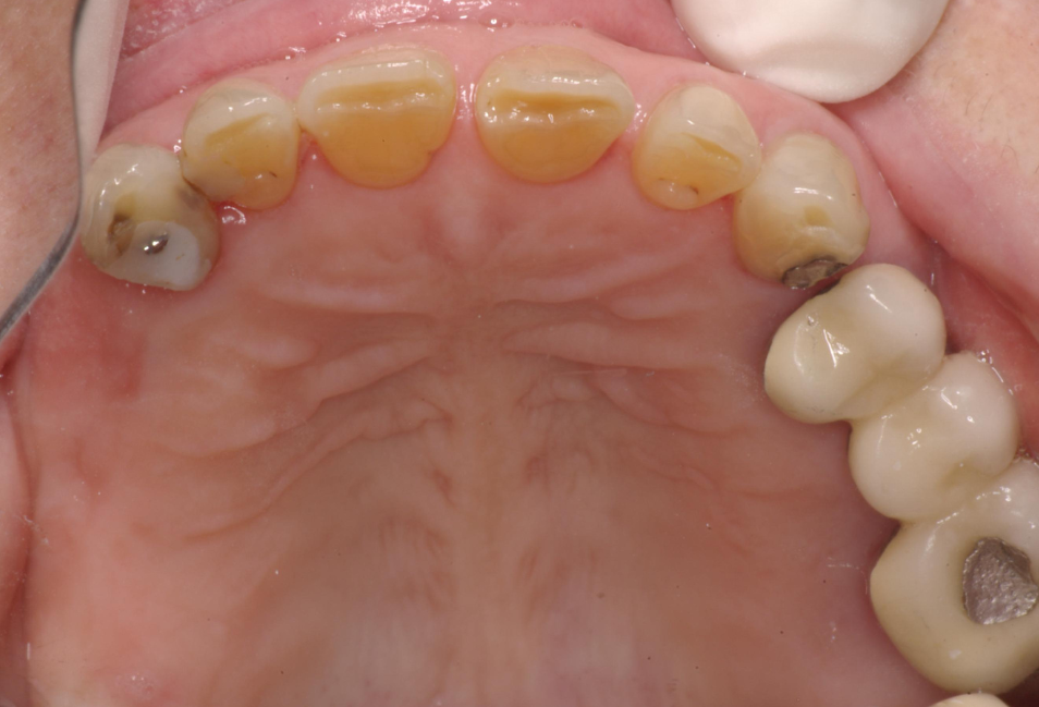 Eastlake Center for  Implants & Restorative Dentistry Eastlake Center for  Implants & Restorative Dentistry