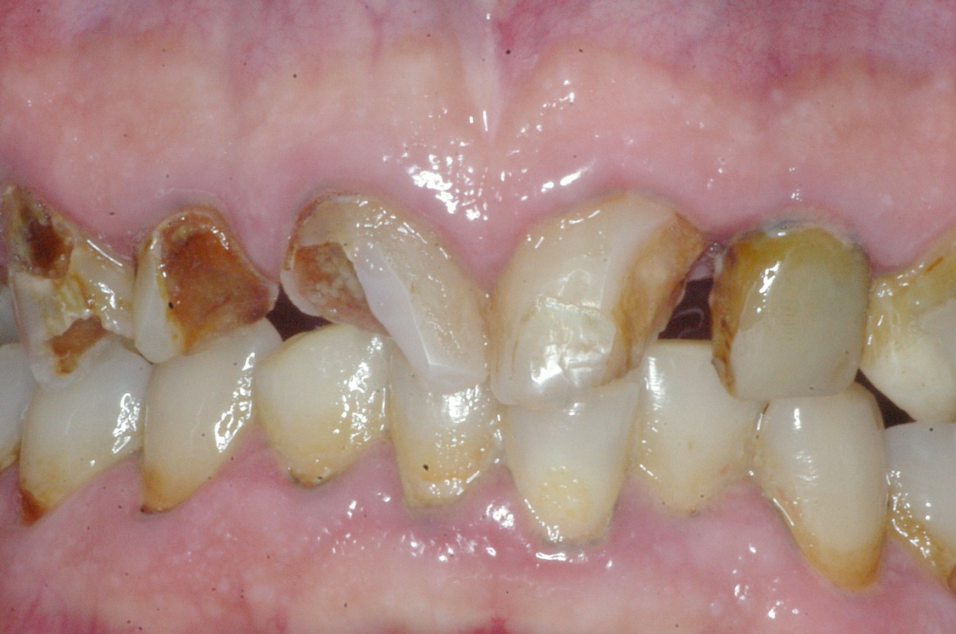 Eastlake Center for  Implants & Restorative Dentistry Eastlake Center for  Implants & Restorative Dentistry
