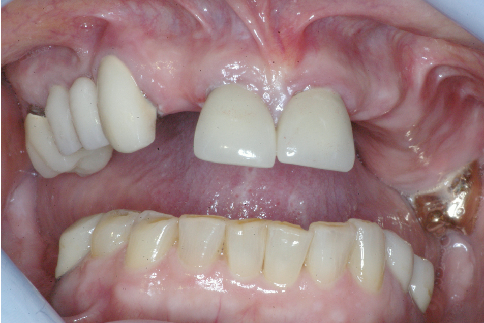 Eastlake Center for  Implants & Restorative Dentistry Eastlake Center for  Implants & Restorative Dentistry
