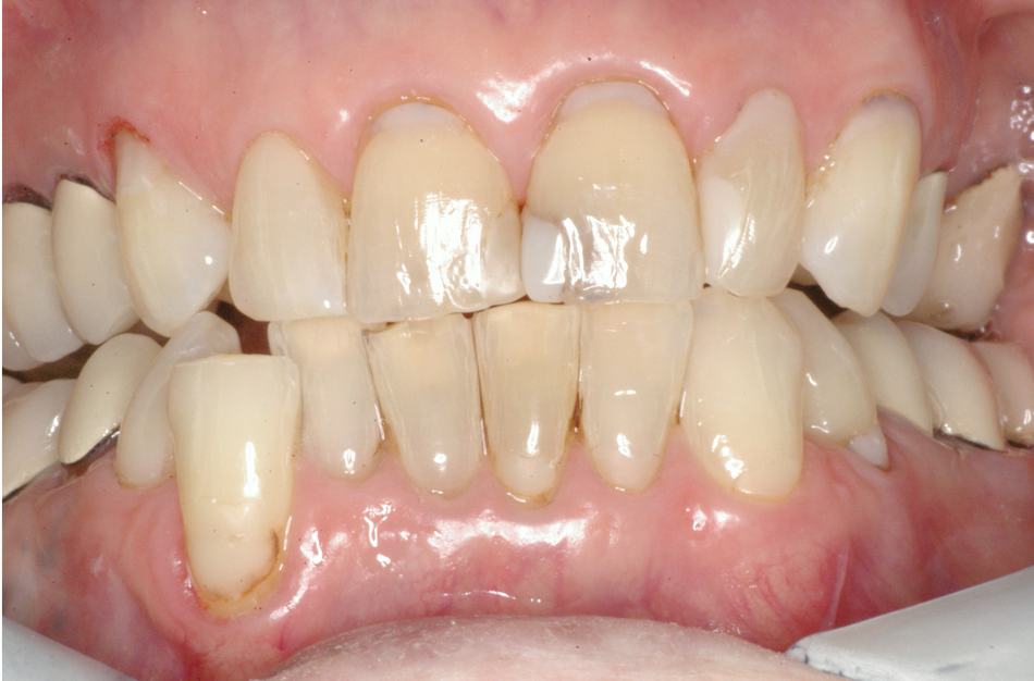 Eastlake Center for  Implants & Restorative Dentistry Eastlake Center for  Implants & Restorative Dentistry