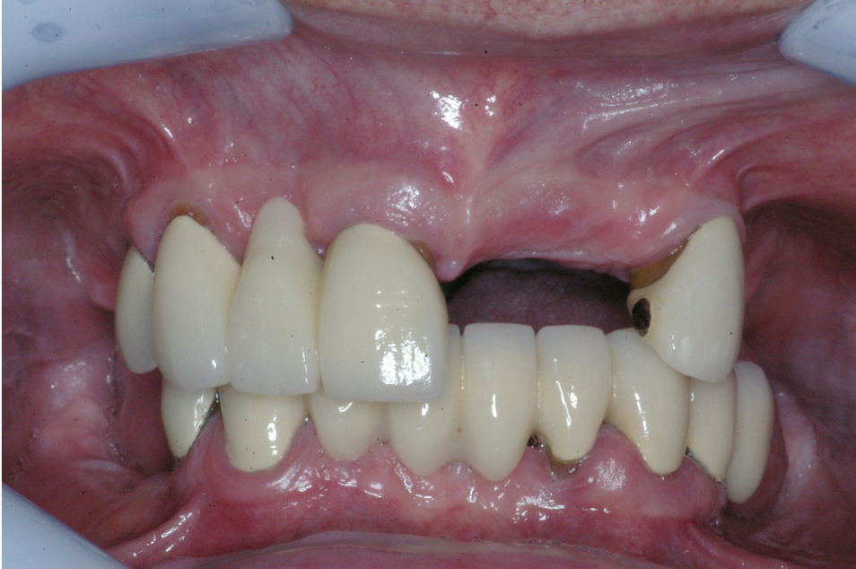 Eastlake Center for  Implants & Restorative Dentistry Eastlake Center for  Implants & Restorative Dentistry
