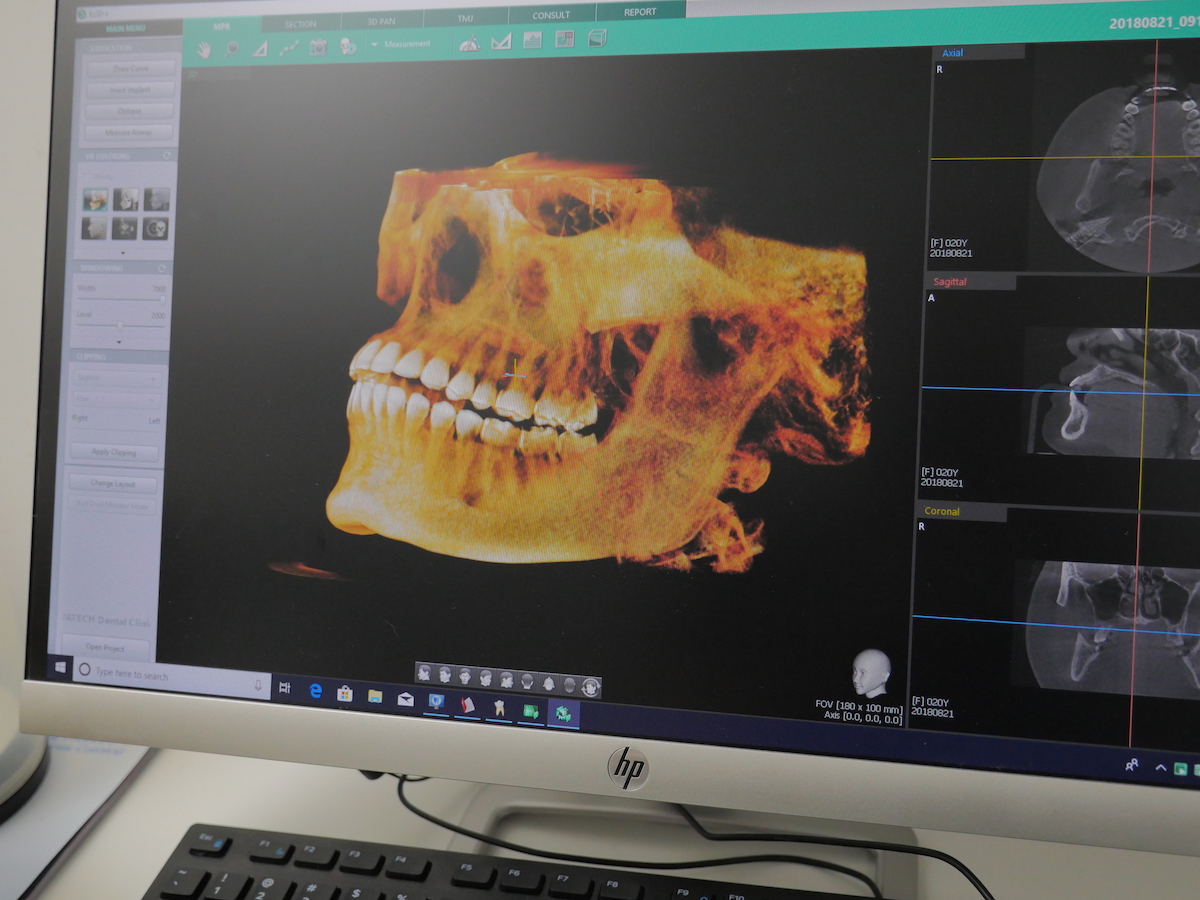 Dental-Imaging-and-Xrays Dental-Imaging-and-Xrays