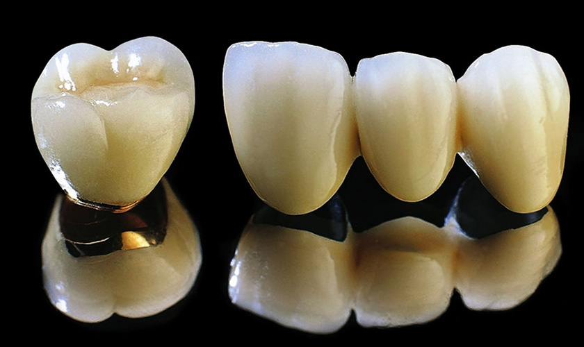 Porcelain_Crowns Porcelain_Crowns